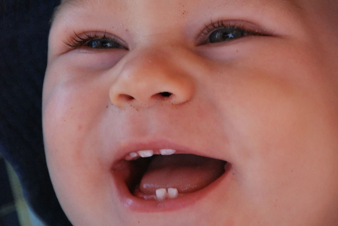 фото зубов у детей до года